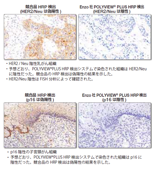POLYVIEW(R) PLUS キット