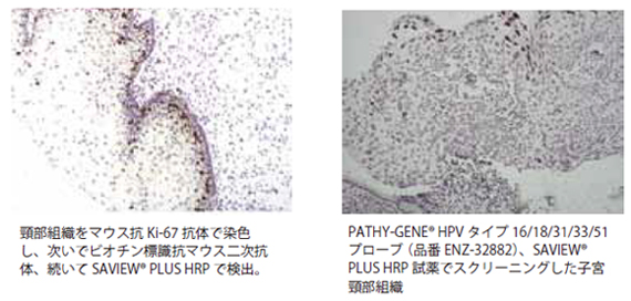 SAVIEW(R) PLUS 試薬