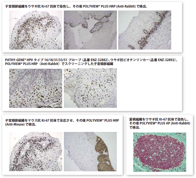 POLYVIEW(R) PLUS 試薬