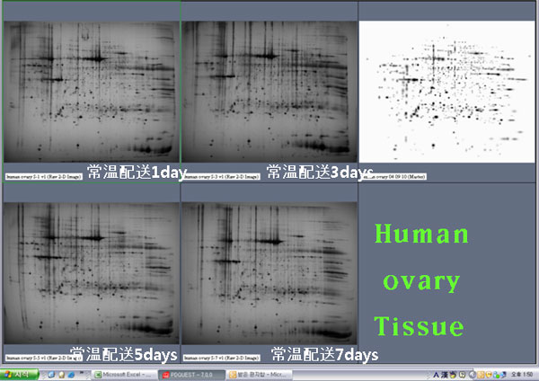 Human ovary Tissue