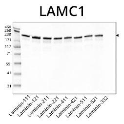 ウェスタンブロットによる抗LAMC1抗体の解析