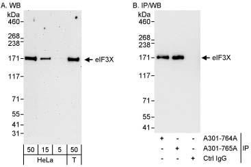 Detection of Human eIF3X by Western Blot and Immunoprecipitation.