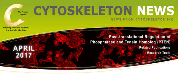 PTEN（Phosphatase and Tensin Homolog）による翻訳後制御