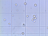 OZK_yatalase_protoplast.gif