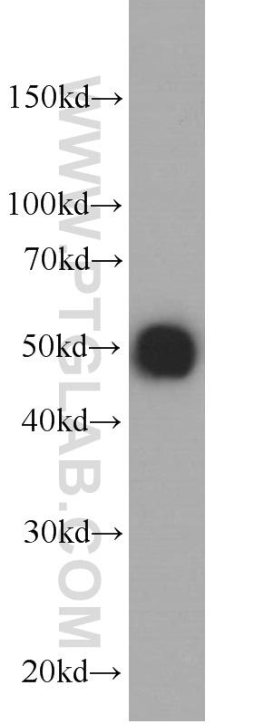 Recombinant protein were subjected to SDS PAGE followed by western blot with 66006-1-Ig( HA-tag Antibody) at dilution of 1:20000 incubated at room temperature for 1.5 hours