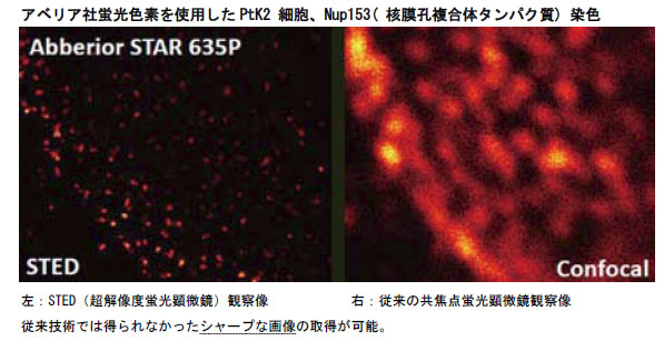 アベリア社蛍光色素を使用したPtK2 細胞、Nup153( 核膜孔複合体タンパク質) 染色