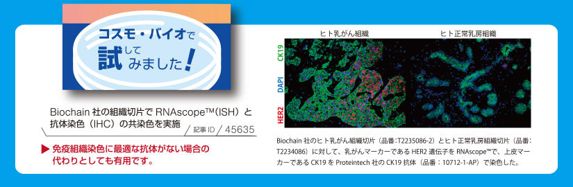 Biochain Ђ̃qggDؕЁiiԁFT2235086-2jƃqg[gDؕЁiiԁFT2234086jɑ΂āA}[J[łHER2 `qRNAscope(TM)ŁA}[J[łCK19 Proteintech ЂCK19 ŔiiԁF10712-1-APjŐFB