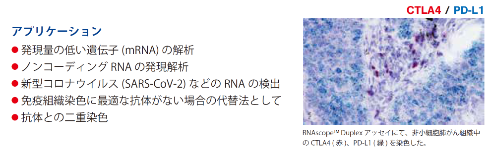 AvP[V  ʂ̒Ⴂ`q(mRNA) ̉  mR[fBORNA ̔  V^RiECX(SARS-CoV-2) ȂǂRNA ̌o  ƉugDFɍœKȍR̂Ȃꍇ֖̑@Ƃ  R̂Ƃ̓dF