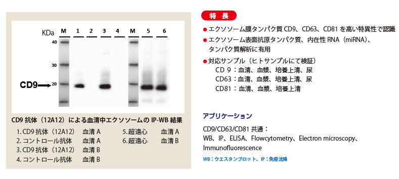 CD9 Ŕi12A12jɂ錌GN\\[IP-WB 