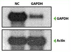 ポジティブGAPDH siRNAおよびネガティブコントロールsiRNAを用いたノックダウン効果を比較