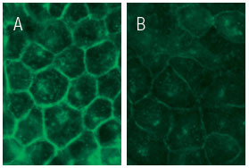 c-Src siRNA（h）（品番：sc-29228）を用いてメタノール固定したHeLa 細胞を免疫蛍光染色