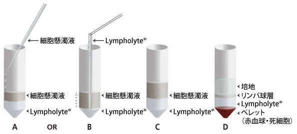 CL_Lympholyte_1.jpg