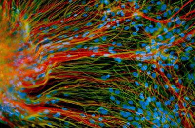 ヒト神経幹細胞と培養関連製品