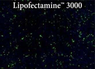 Lipofectamine 3000 試薬を用いたHeLa細胞へのトランスフェクション結果の写真