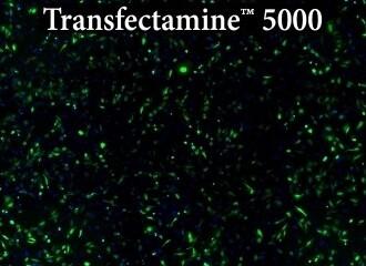 Lipofectamine 5000 試薬を用いたHeLa細胞へのトランスフェクション結果の写真