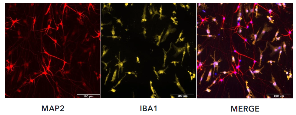 ioGlutamatergic neurons と ioMicroglia の共培養をした様子を撮影した写真