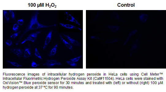 品番11504を使用したHeLa細胞中の過酸化水素の蛍光画像