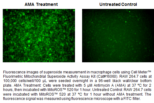 品番16060を使用し、AMA処理したマクロファージ (RAW264.7細胞) のスーパーオキシド測定の蛍光画像