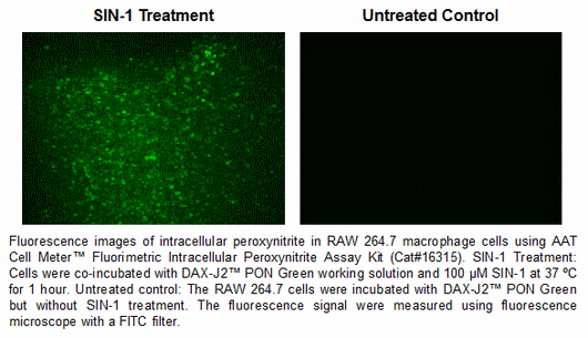 品番：16315 を使った RAW264.7 マクロファージ細胞の細胞内ペルオキシナイトライトの蛍光画像