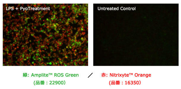 細胞内一酸化窒素 (NO) とトータルROS の同時蛍光イメージング