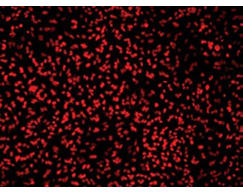 HeLa細胞の蛍光画像