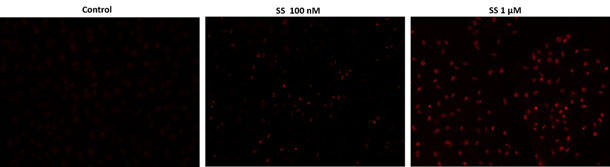 スタウロスポリン処理したHeLa細胞におけるTUNEL反応の蛍光画像