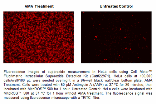 品番22971を使用し、AMA処理したHeLa細胞のスーパーオキシド測定の蛍光画像
