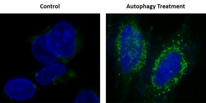 HeLaזEɋQԂU Autophagy Green™ WE