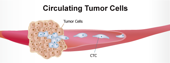 Circulating Tumor CellsiCTCsAzᇍזEj