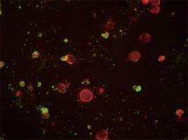 EB71感染細胞中のVP1を免疫蛍光染色