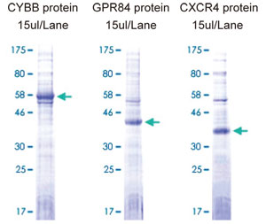 ABV_Proteoliposome_1.jpg