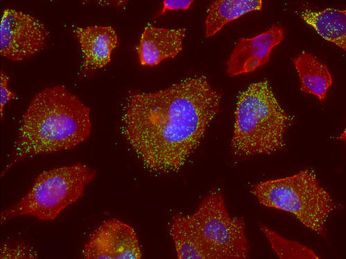 RNAscope®マルチプレックス蛍光アッセイによる、培養細胞のIL-8およびbeta-ActinのmRNA発現