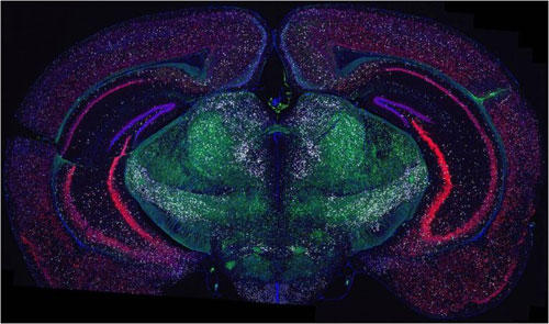 マウス脳FFPE組織切片の神経マーカーの検出 