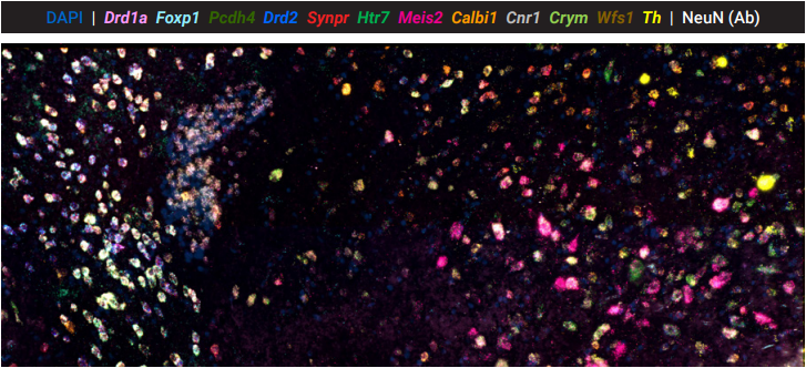 RNAscope® HiPlexアッセイによる12ターゲットの染色と免疫組織染色を組み合わせた染色例