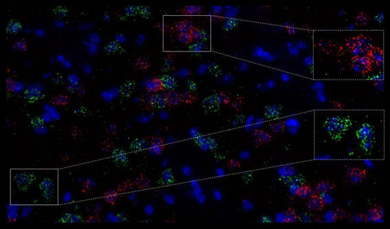 }EX̐VNؕЂɂāARNAscope(R) Multiplex Fluorescent Assay ɂDRD1iԁj, DRD2i΁j̐F