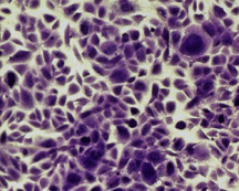 Human Dermal Fibroblast Cells 10X