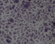 Human Dermal Fibroblast Cells 10X