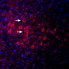 Postsynaptic Density-95