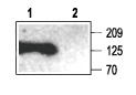 Postsynaptic Density-95