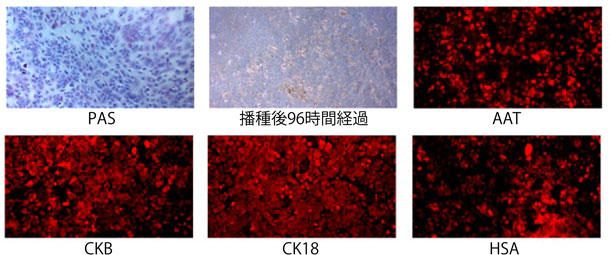 APB_Enhanced_Primary_hepatocytes_HU_01.jpg