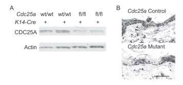 Cdc25a変異上皮においてCDC25Aタンパク質が低減