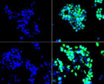 アデノウイルスによりSOX2とOCT4を導入した48時間後のMDA-MB-468細胞をマウス抗OCT4またはSOX2モノクローナル抗体で免疫細胞化学染色した。