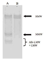 veA[[ِFWB́b}EXHMW & Total AfB|lN`