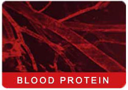 ATL_Blood_Protein_HPA_8.jpg