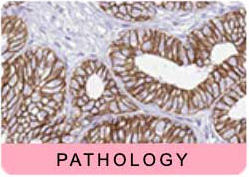 ATL_Pathology_HPA_5.jpg