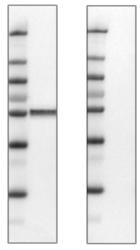 ATL_prest_antigens