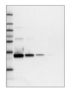 ATL_prest_antigens