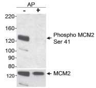 EFX^ubgqg_ MCM2 (Ser41) ̌o