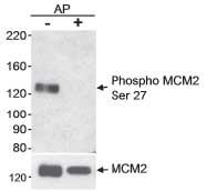 EFX^ubgqg_ MCM2 (Ser27) ̌o