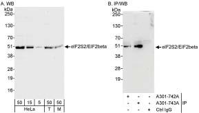 Detection of Human and Mouse eIF2beta/EIF2S2 by Western Blot (h&m) and Immunoprecipitation (h).